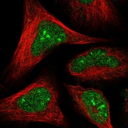 HD domain containing 2 Antibody, Novus Biologicals:Antibodies:Primary Antibodies
